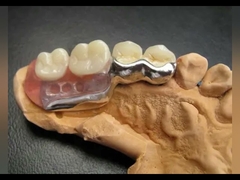 Dental Lab Long Lasting Precision Attachment Denture Stain Resistant