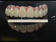 Zirconia Dental Crown: Natural-looking Teeth, Durable & Secure