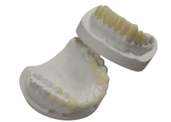 Υψηλής αντοχής CAD CAM 3D Printing Temporary Crowns Durable Resin