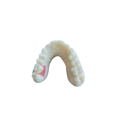 Ψηφιακή στοματική σάρωση PFM Dental Crowns Bridge Εμφυτευματολογία Απαιτήσεις