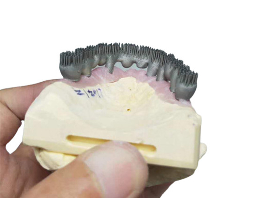 Ανθεκτικές CAD CAM PFM τρισδιάστατες τυπωμένες ύλες εργαστηρίων εκτυπωτών οδοντικές για την έρευνα