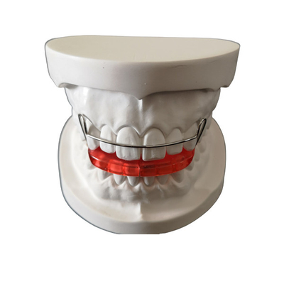 Positioner δοντιών cOem συνήθειας Orthodontics απλό εγκαθιστά εύκολο διατηρεί