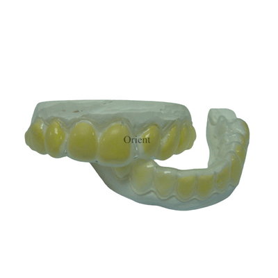 Οι Orthodontic συσκευές FDA είναι αντιδιαβρωτικές και ανθεκτικές