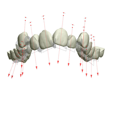 Καλό Biocompatibility καθόρισε το Orthodontic λαστιχένιο υπηρέτη συσκευών