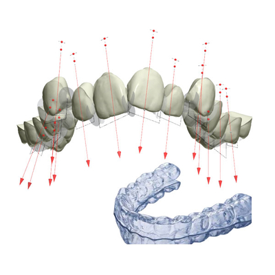 Ο υπηρέτης ενισχύει σταθερή τη FDA Orthodontic συσκευή με τρισδιάστατο