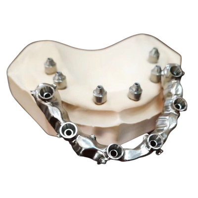 FDA 3014652903 οδοντικός ιδιαίτερα αισθητικός εξαιρετικά ισχυρός γεφυρών PFM
