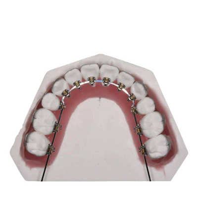 Το ευθύ καλώδιο καθόρισε τις Orthodontic συσκευές για την αποκατάσταση δοντιών