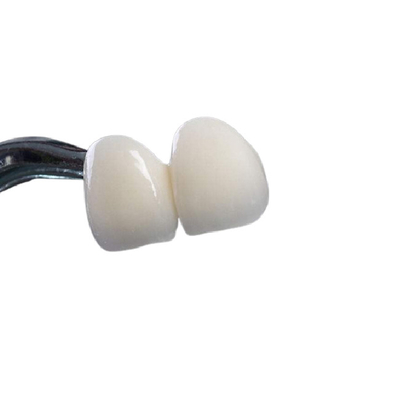 Καλή οδοντική κορώνα Biocompatibility Zirconia μη που ενοχλεί τον εύκολο καθαρισμό
