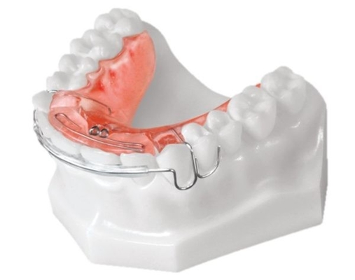 Οι οδοντικές Orthodontic συσκευές απλές εγκαθιστούν το βιολογικό υλικό υψηλής τεχνολογίας