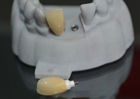 Εξατομικευμένο κολόβωμα CAD PEEK