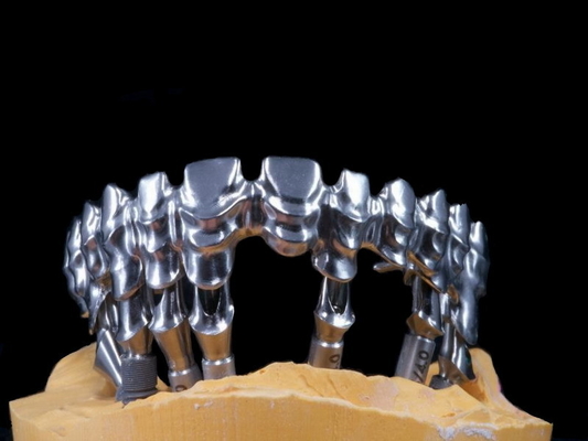 FDA 3014652903 οδοντικός ιδιαίτερα αισθητικός εξαιρετικά ισχυρός γεφυρών PFM