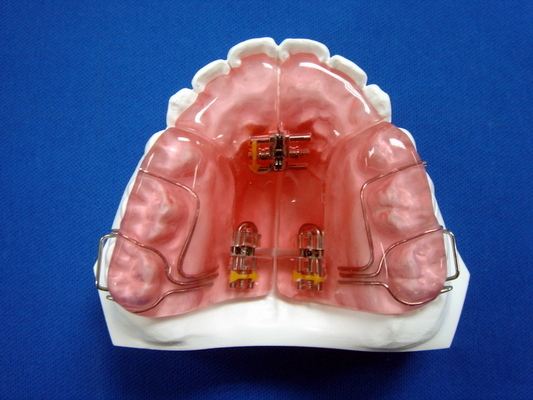Ο μετακινούμενος cOem συνήθειας καθόρισε τη Orthodontic καλή διάρκεια συσκευών