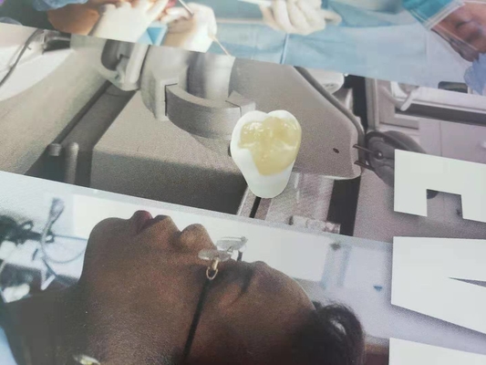 Ανθεκτικό Inlay Onlay καπλαμάδων κορωνών FDA όλος-κεραμικό οδοντικό παρόμοιο