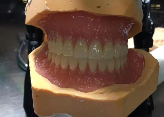 CAD-CAM οι λαστιχένιες τρισδιάστατες τυπωμένες κορώνες είναι εύκολο να διατηρηθούν και να εγκαταστήσουν