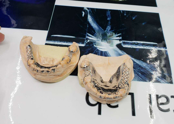 Το υψηλό CAD-CAM ακρίβειας καθόρισε το μετακινούμενο σχέδιο ψηφιακής αναλογικής μεταλλαγής γεφυρών