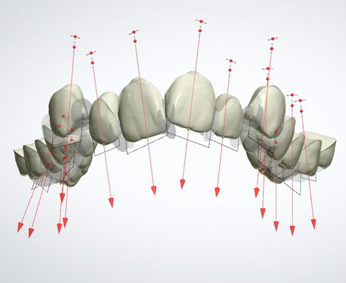 Καλό Biocompatibility καθόρισε το Orthodontic λαστιχένιο υπηρέτη συσκευών