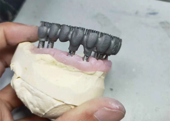 Ανθεκτικές CAD CAM PFM τρισδιάστατες τυπωμένες ύλες εργαστηρίων εκτυπωτών οδοντικές για την έρευνα