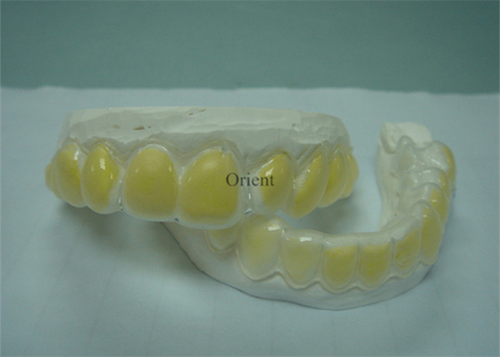 Οι Orthodontic συσκευές FDA είναι αντιδιαβρωτικές και ανθεκτικές