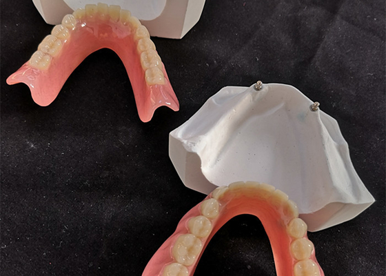 Το άνετο οδοντικό μόσχευμα Overdenture CAM CAD εύκολο διατηρεί