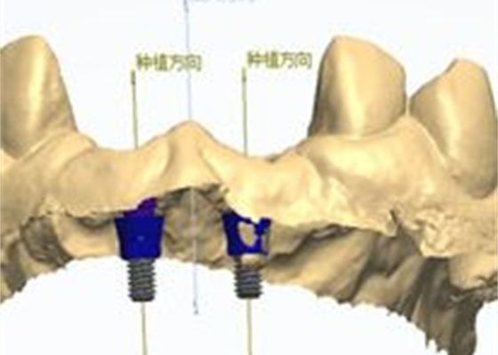 Τριδιάστατο μοντέλο Κρόνος από ζιρκόνια