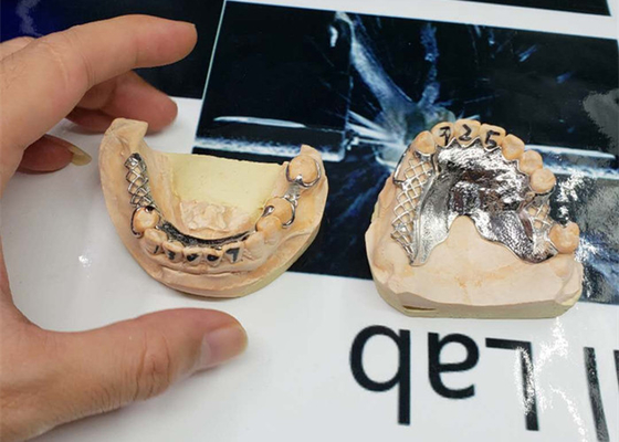 Το υψηλό CAD-CAM ακρίβειας καθόρισε το μετακινούμενο σχέδιο ψηφιακής αναλογικής μεταλλαγής γεφυρών
