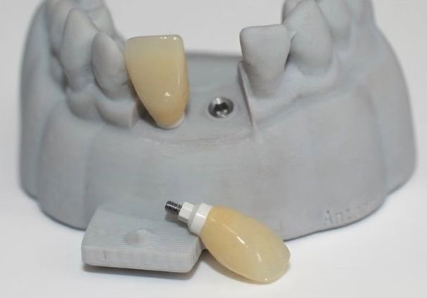 Εξατομικευμένο κολόβωμα CAD PEEK